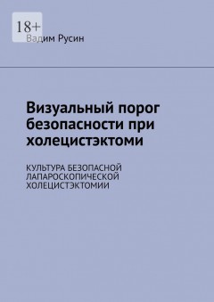 Визуальный порог безопасности при холецистэктоми. Культура безопасной лапароскопической холецистэктомии