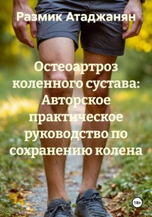 Остеоартроз коленного сустава: Авторское практическое руководство по сохранению колена