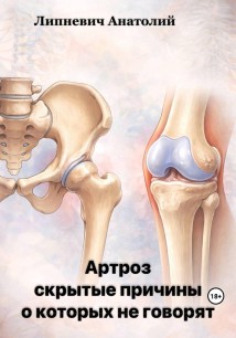 Артроз: скрытые причины, о которых не говорят
