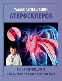 Атеросклероз. Все о лечении, диете и поддержании здоровья сосудов